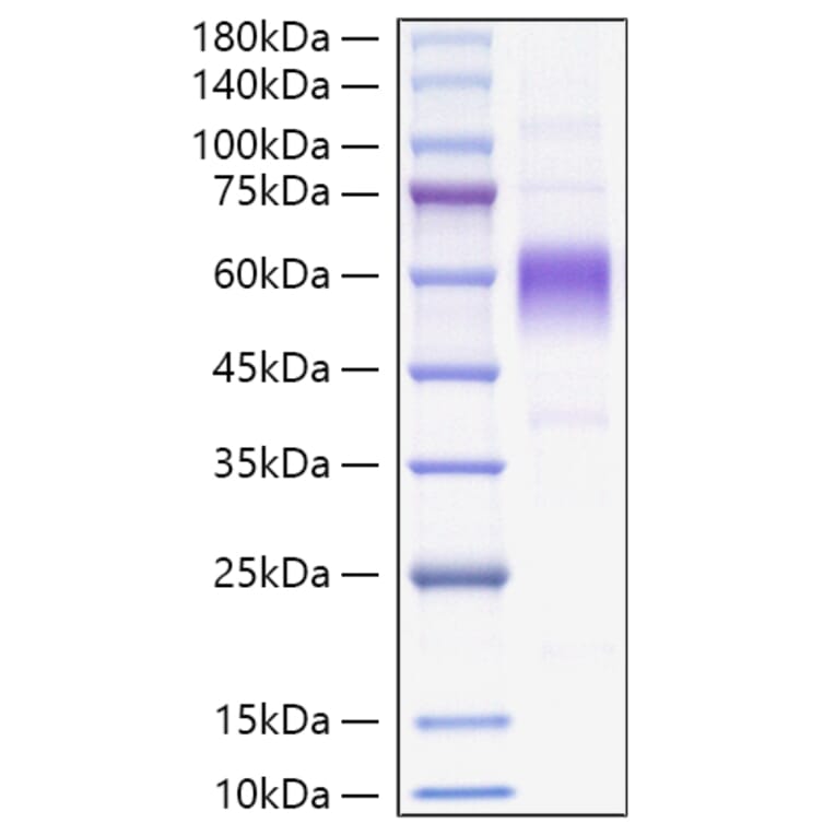 SDS-PAGE - Recombinant Monkeypox virus B16R Protein (C-terminal His Tag) (A329070) - Antibodies.com