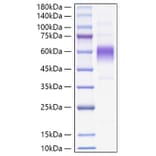 SDS-PAGE - Recombinant Monkeypox virus B16R Protein (C-terminal His Tag) (A329070) - Antibodies.com