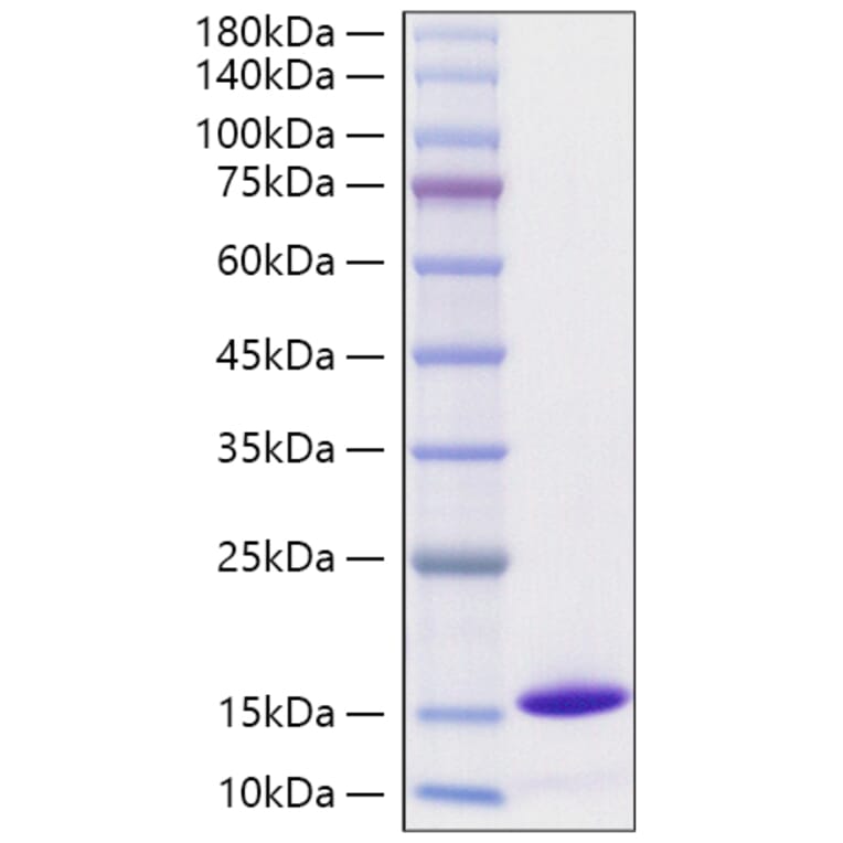 SDS-PAGE - Recombinant Monkeypox virus D6L Protein (C-terminal His Tag) (A329071) - Antibodies.com