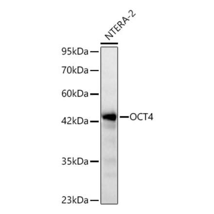 Western Blot - Anti-OCT4 Antibody (A329072) - Antibodies.com