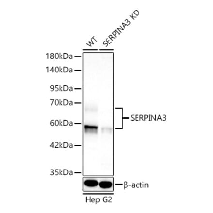 Western Blot - Anti-AACT Antibody (A329077) - Antibodies.com