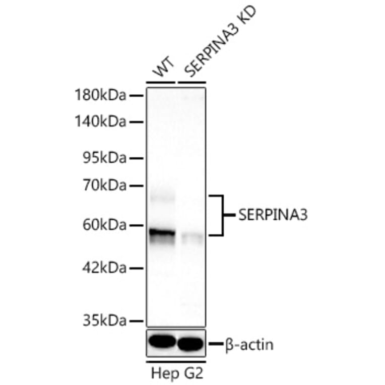 Western Blot - Anti-AACT Antibody (A329077) - Antibodies.com