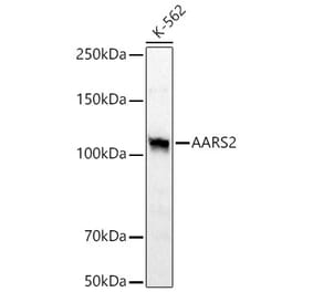 Western Blot - Anti-AARS2 Antibody (A329078) - Antibodies.com