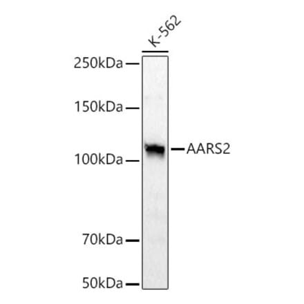 Western Blot - Anti-AARS2 Antibody (A329078) - Antibodies.com