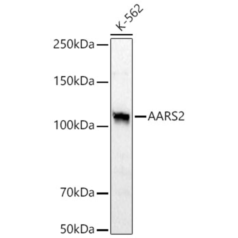 Western Blot - Anti-AARS2 Antibody (A329078) - Antibodies.com