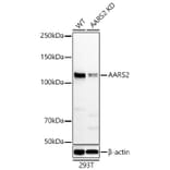 Western Blot - Anti-AARS2 Antibody (A329078) - Antibodies.com