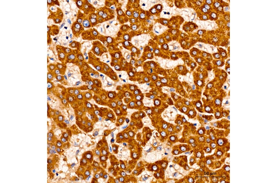 Immunohistochemistry - Anti-AASS Antibody (A329079) - Antibodies.com