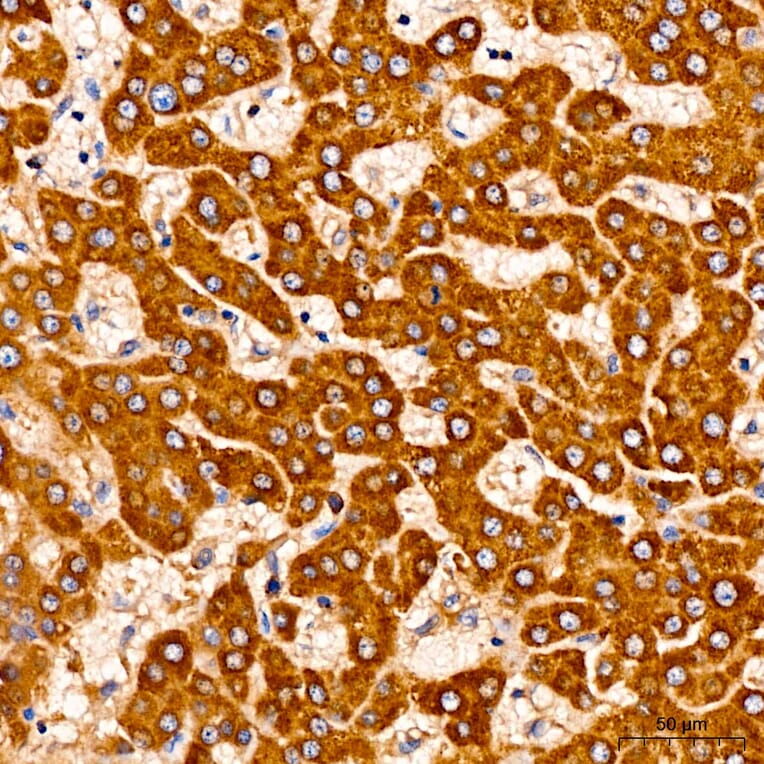 Immunohistochemistry - Anti-AASS Antibody (A329079) - Antibodies.com