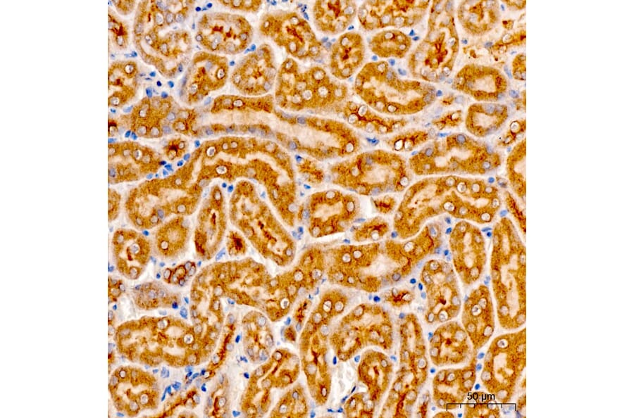 Immunohistochemistry - Anti-AASS Antibody (A329079) - Antibodies.com