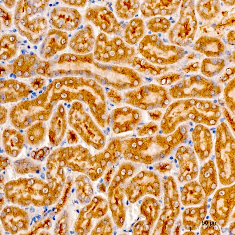 Immunohistochemistry - Anti-AASS Antibody (A329079) - Antibodies.com