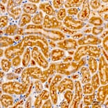 Immunohistochemistry - Anti-AASS Antibody (A329079) - Antibodies.com