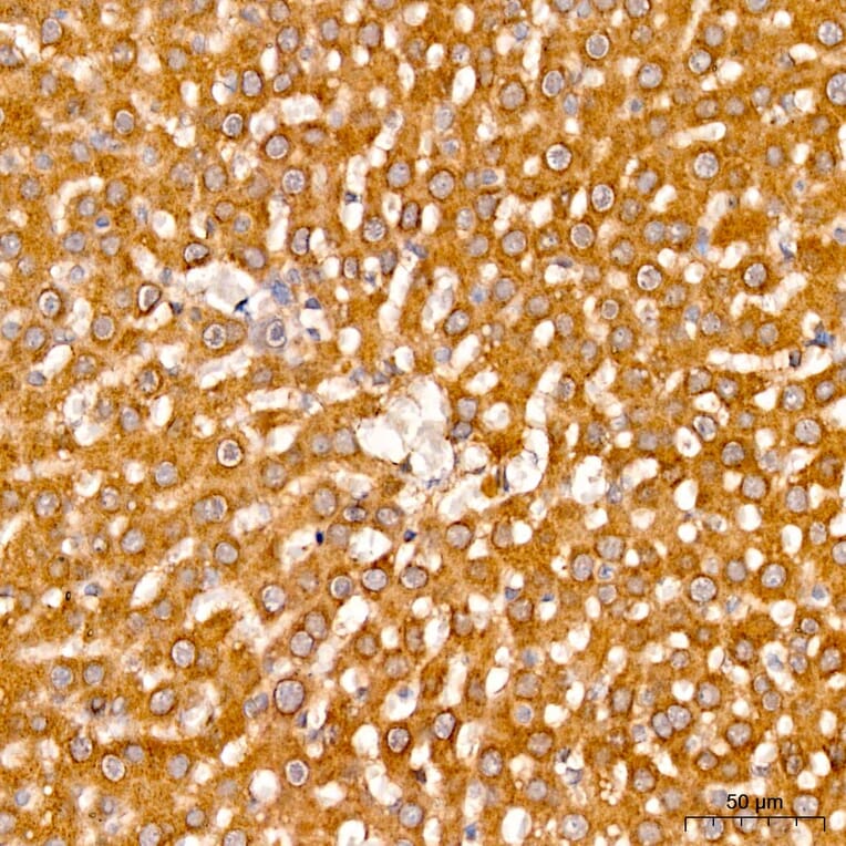 Immunohistochemistry - Anti-AASS Antibody (A329079) - Antibodies.com
