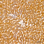 Immunohistochemistry - Anti-AASS Antibody (A329079) - Antibodies.com
