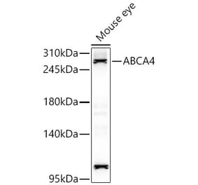 Western Blot - Anti-ABCA4 Antibody (A329080) - Antibodies.com