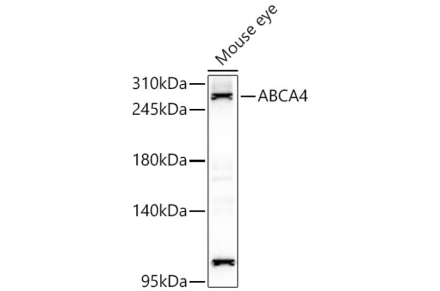 Western Blot - Anti-ABCA4 Antibody (A329080) - Antibodies.com