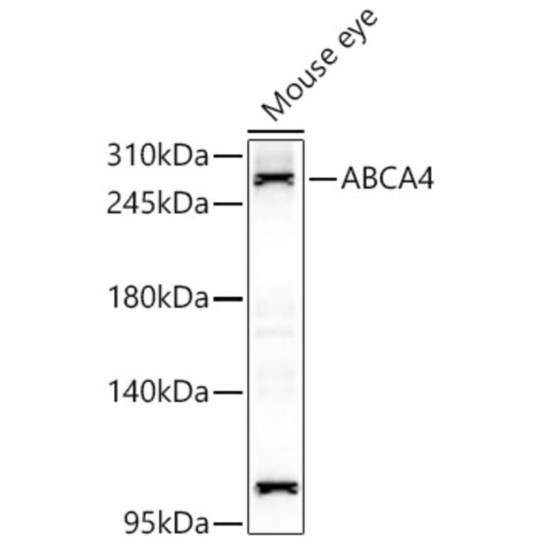 Western Blot - Anti-ABCA4 Antibody (A329080) - Antibodies.com