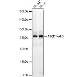 Western Blot - Anti-ABCD1 Antibody [ARC3076] (A329081) - Antibodies.com