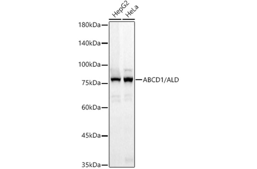 Western Blot - Anti-ABCD1 Antibody [ARC3076] (A329081) - Antibodies.com