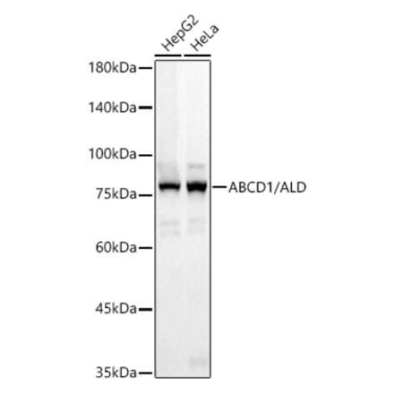 Western Blot - Anti-ABCD1 Antibody [ARC3076] (A329081) - Antibodies.com