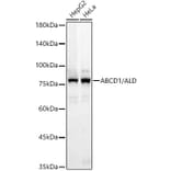 Western Blot - Anti-ABCD1 Antibody [ARC3076] (A329081) - Antibodies.com