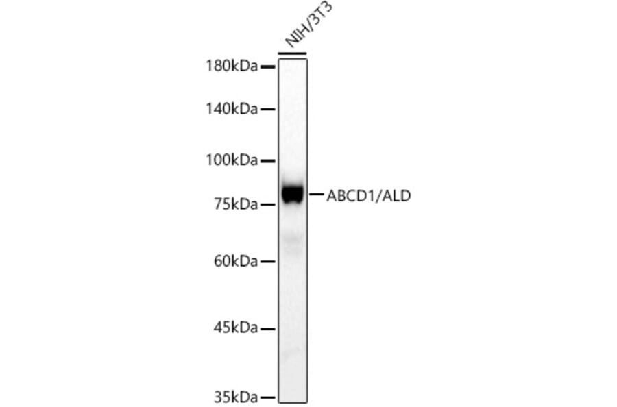 Western Blot - Anti-ABCD1 Antibody [ARC3076] (A329081) - Antibodies.com