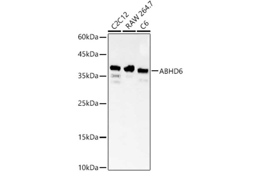 Western Blot - Anti-ABHD6 Antibody (A329082) - Antibodies.com