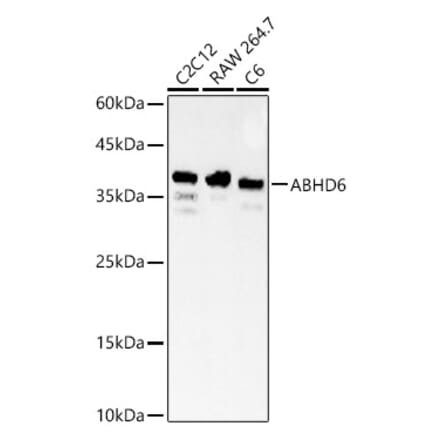 Western Blot - Anti-ABHD6 Antibody (A329082) - Antibodies.com