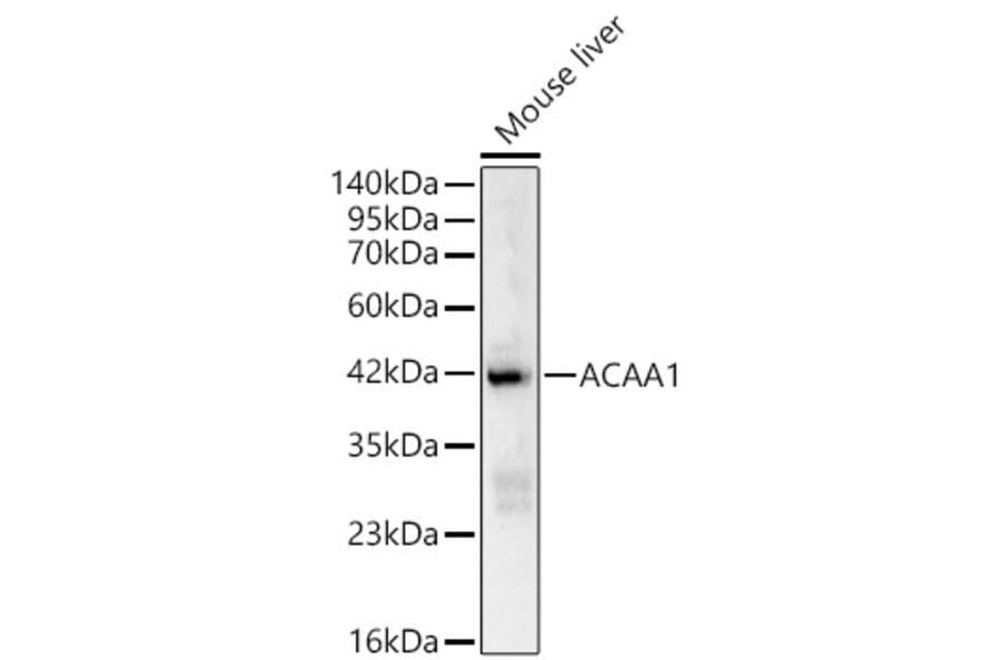 Western Blot - Anti-ACAA1 Antibody (A329084) - Antibodies.com