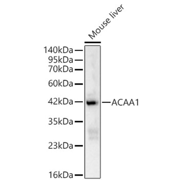 Western Blot - Anti-ACAA1 Antibody (A329084) - Antibodies.com