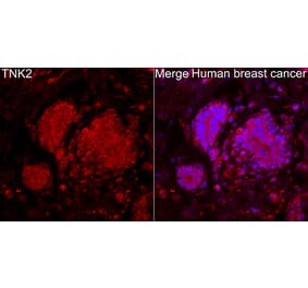 Immunofluorescence - Anti-ACK1 Antibody (A329088) - Antibodies.com