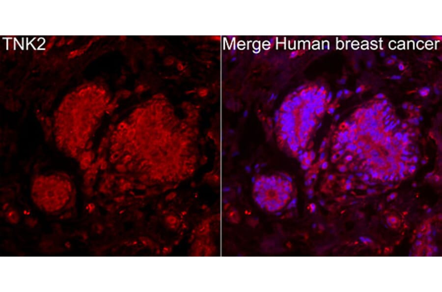 Immunofluorescence - Anti-ACK1 Antibody (A329088) - Antibodies.com