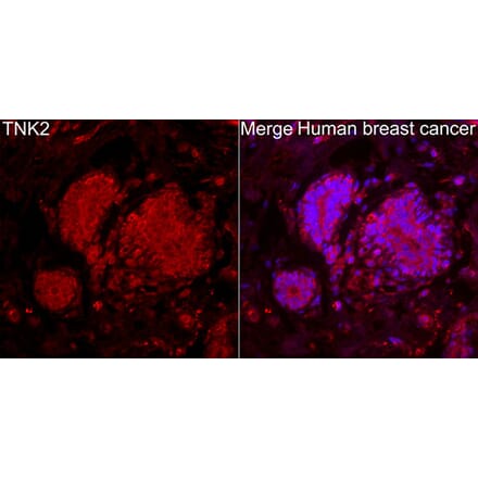 Immunofluorescence - Anti-ACK1 Antibody (A329088) - Antibodies.com