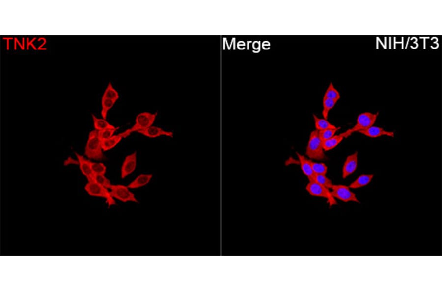 Immunofluorescence - Anti-ACK1 Antibody (A329088) - Antibodies.com