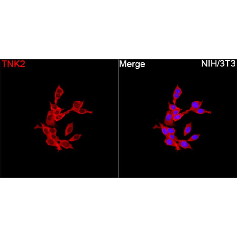 Immunofluorescence - Anti-ACK1 Antibody (A329088) - Antibodies.com