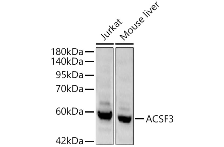 Western Blot - Anti-ACSF3 Antibody (A329089) - Antibodies.com