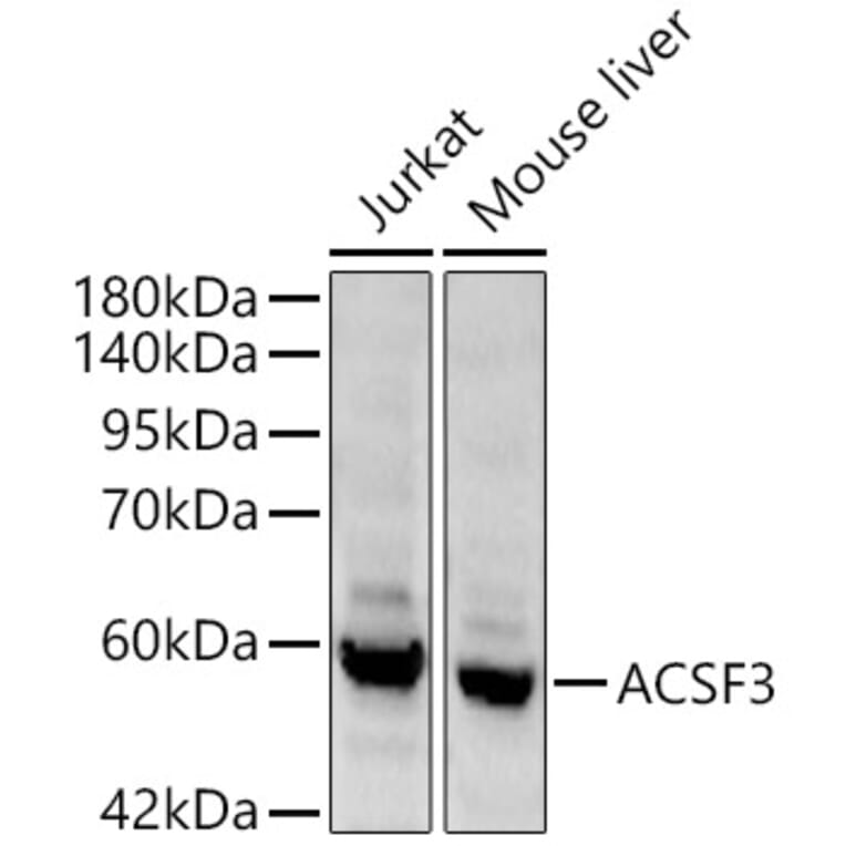 Western Blot - Anti-ACSF3 Antibody (A329089) - Antibodies.com