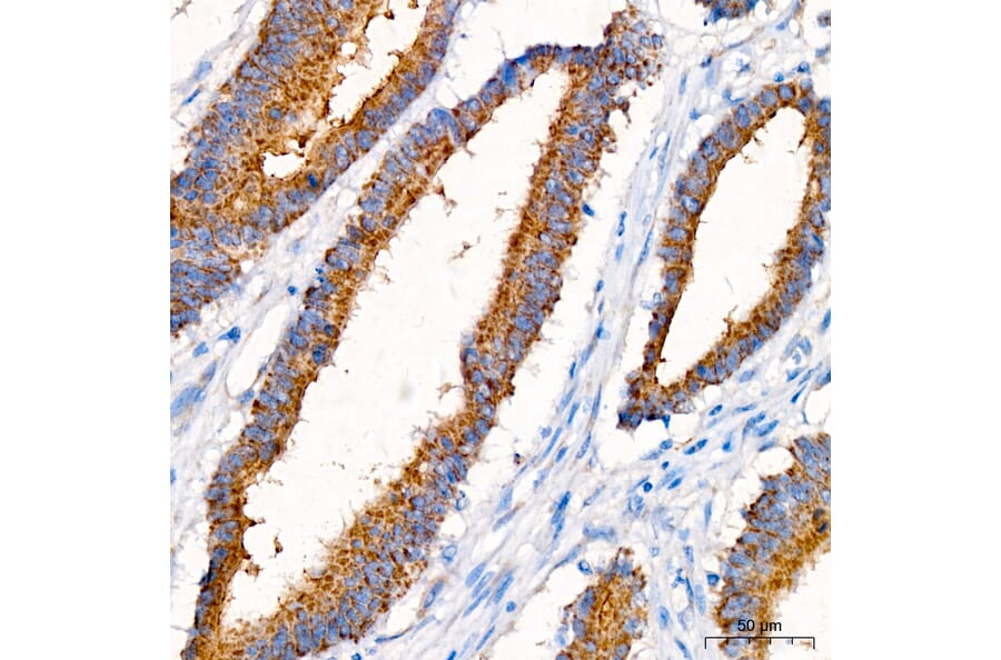 Immunohistochemistry - Anti-ACSF3 Antibody (A329089) - Antibodies.com