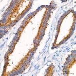 Immunohistochemistry - Anti-ACSF3 Antibody (A329089) - Antibodies.com