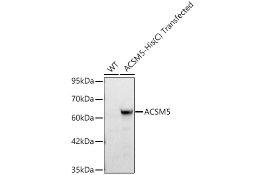 Western Blot - Anti-ACSM5 Antibody (A329092) - Antibodies.com