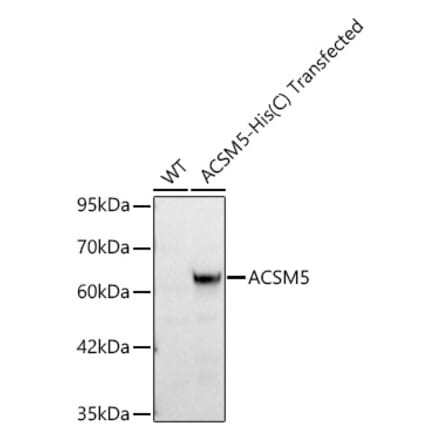 Western Blot - Anti-ACSM5 Antibody (A329092) - Antibodies.com
