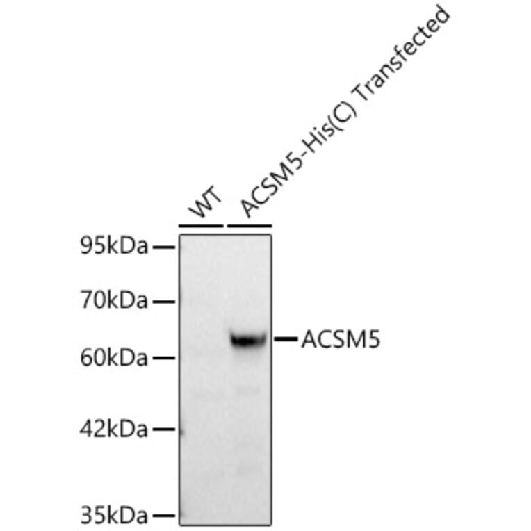 Western Blot - Anti-ACSM5 Antibody (A329092) - Antibodies.com