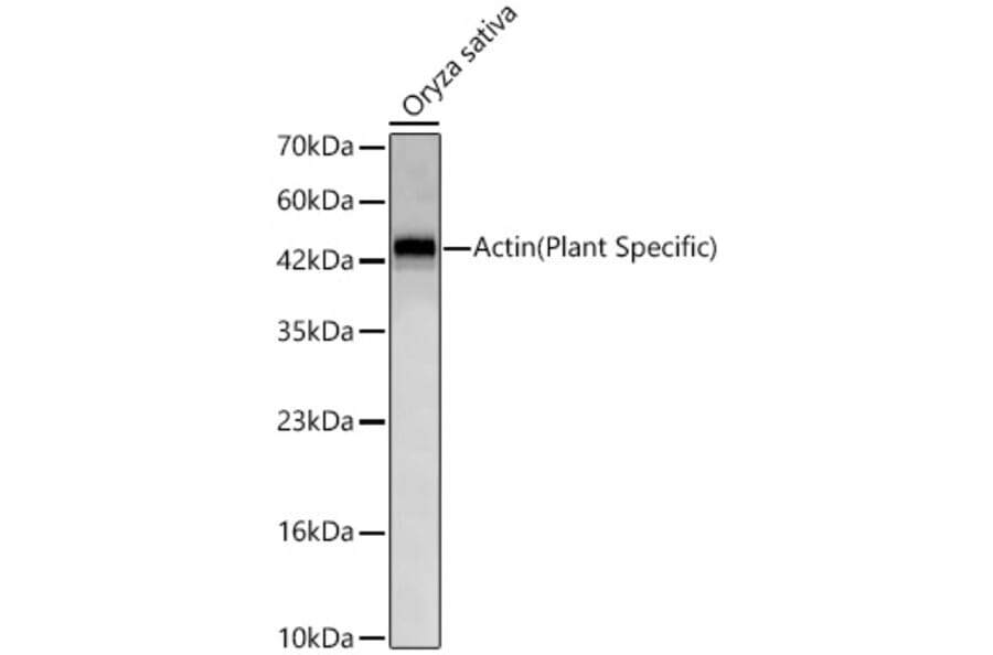 Western Blot - Anti-Actin Antibody [ARC62861] (A329093) - Antibodies.com