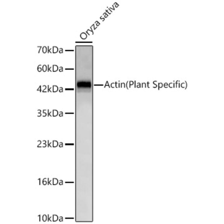 Western Blot - Anti-Actin Antibody [ARC62861] (A329093) - Antibodies.com
