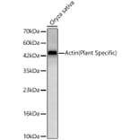 Western Blot - Anti-Actin Antibody [ARC62861] (A329093) - Antibodies.com