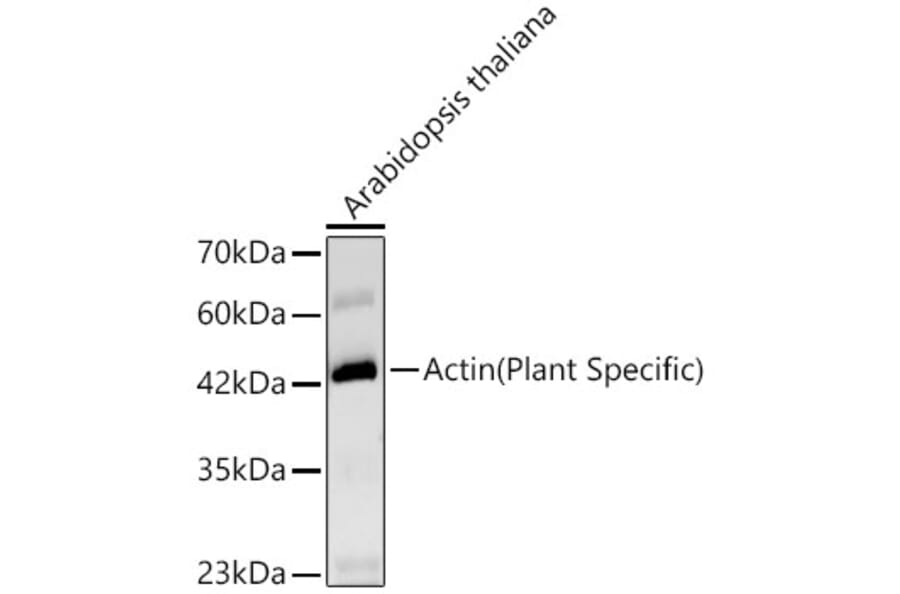 Western Blot - Anti-Actin Antibody [ARC62861] (A329093) - Antibodies.com