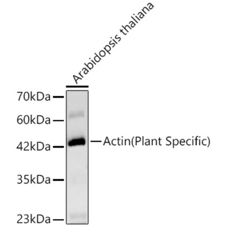 Western Blot - Anti-Actin Antibody [ARC62861] (A329093) - Antibodies.com