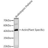 Western Blot - Anti-Actin Antibody [ARC62861] (A329093) - Antibodies.com