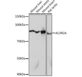 Western Blot - Anti-ACVR2A Antibody [ARC1220] (A329094) - Antibodies.com