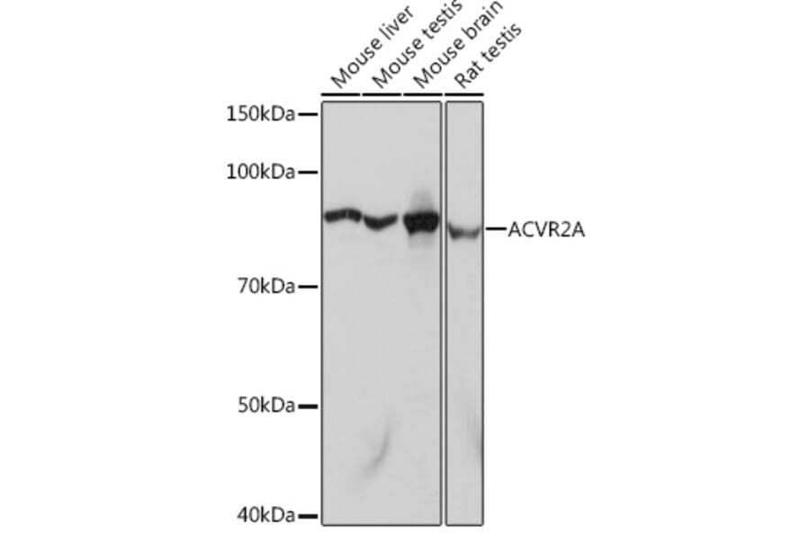 Western Blot - Anti-ACVR2A Antibody [ARC1220] (A329094) - Antibodies.com