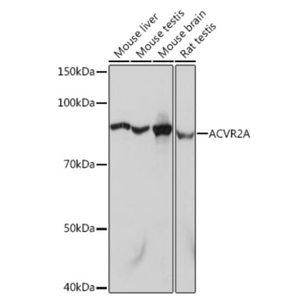 Western Blot - Anti-ACVR2A Antibody [ARC1220] (A329094) - Antibodies.com